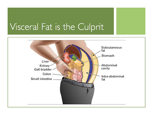 visceralfat