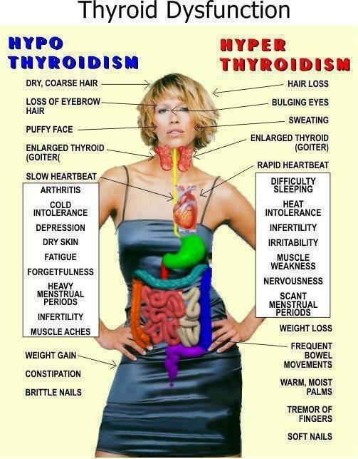 Thyroid-symptons